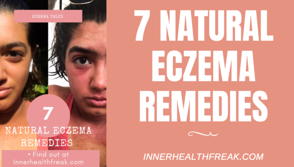 7 Natural Eczema Remedies