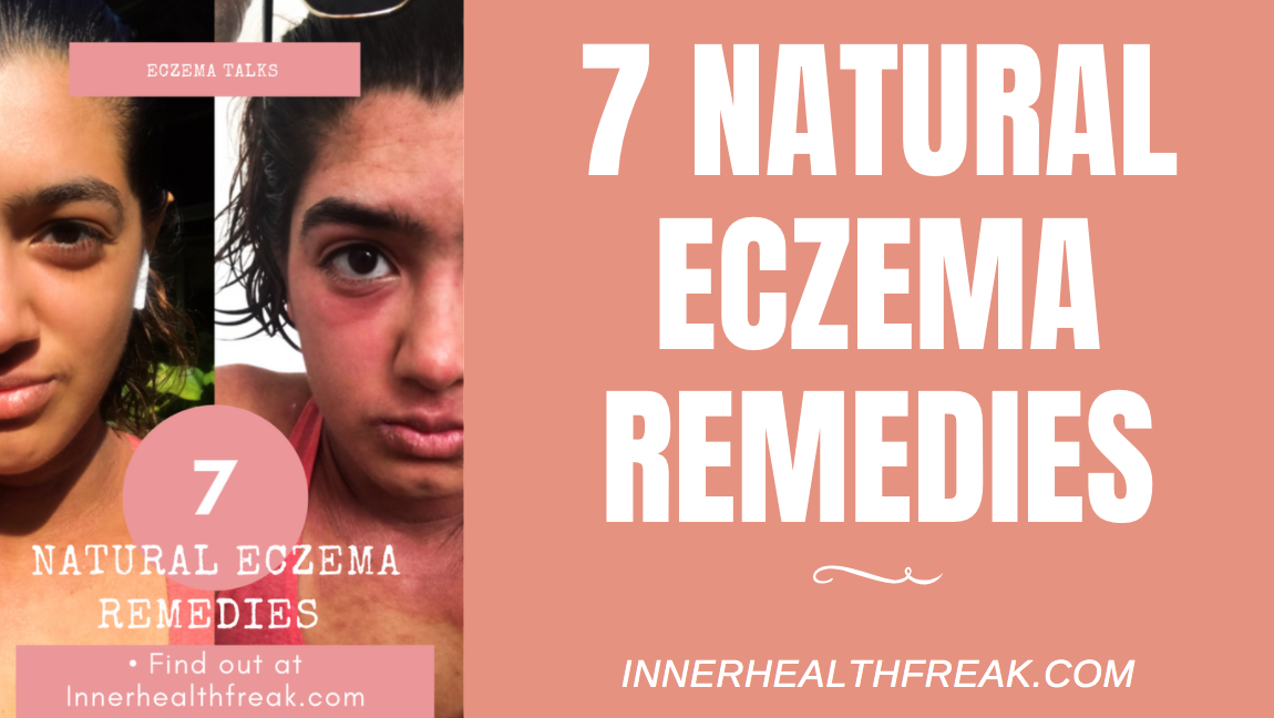 7 Natural Eczema Remedies